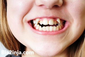 چرا دندان‌های بیشتر افراد نامرتب است ؟